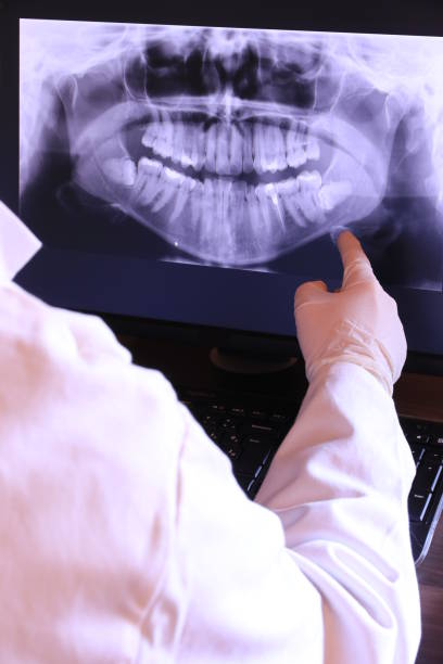 Best Knocked-Out Tooth (Avulsed Tooth) Treatment in Upper Pohatcong, NJ